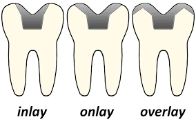 Dental Krišto