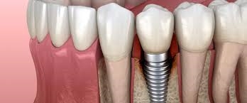 Dental Krišto