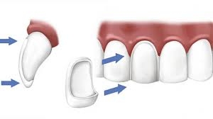 Dental Krišto