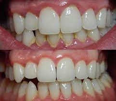 Dental Krišto
