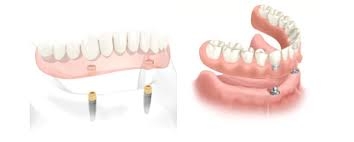 Dental Krišto